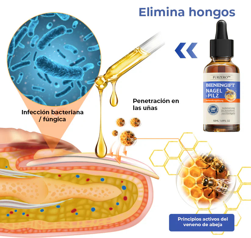 ELIMINA LOS HONGOS DE LAS UÑAS EN 5 DÍAS Y EVITA QUE APEREZCAN PARA SIEMPRE