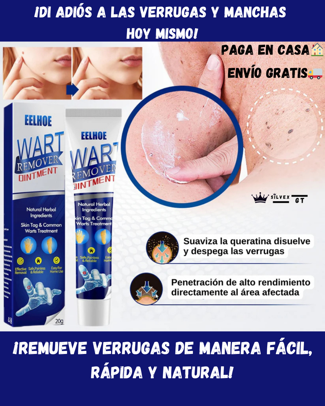 GEL WARTREMOVER ELIMINA VERRUGAS, LUNARES Y MANCHAS DE TU PIEL-TOP EN VENTAS