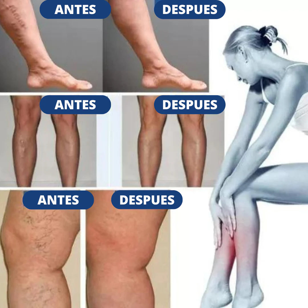 PARCHE ANTIVARICES-2 PACK-24 PARCHES