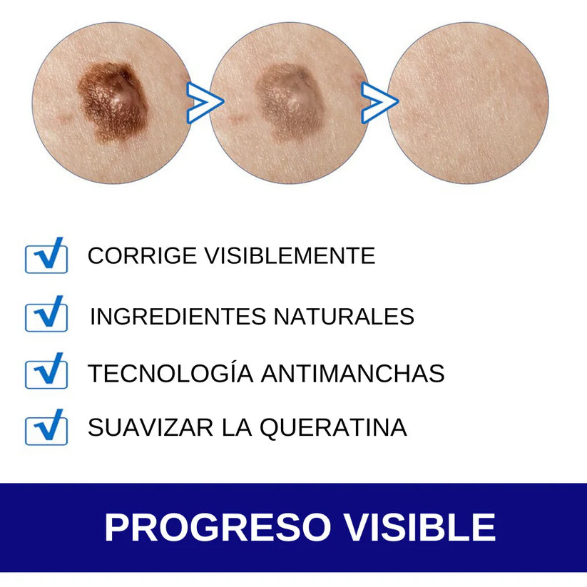 GEL WARTREMOVER ELIMINA VERRUGAS, LUNARES Y MANCHAS DE TU PIEL-TOP EN VENTAS