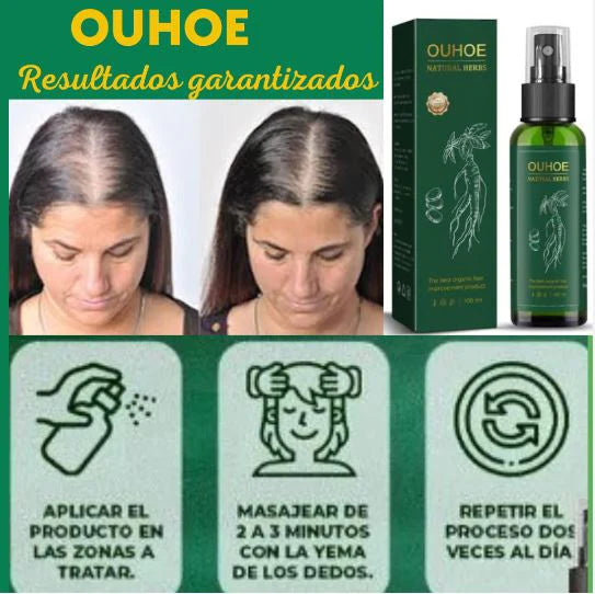 OUHOE - ELIXIR PARA EL CRECIMIENTO DEL CABELLO-ALTA CALIDAD